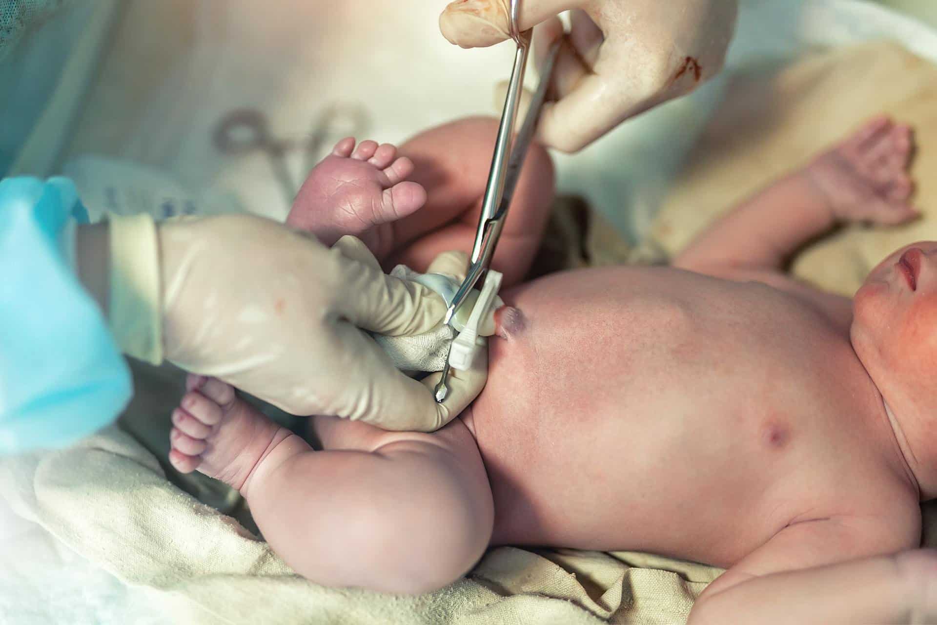 Close-up doctor obstetrician nurse cutting umbilical cord with medical scissors to newborn baby
