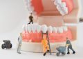 miniature people to repair a tooth or worker cleaning tooth model as medical and healthcare
