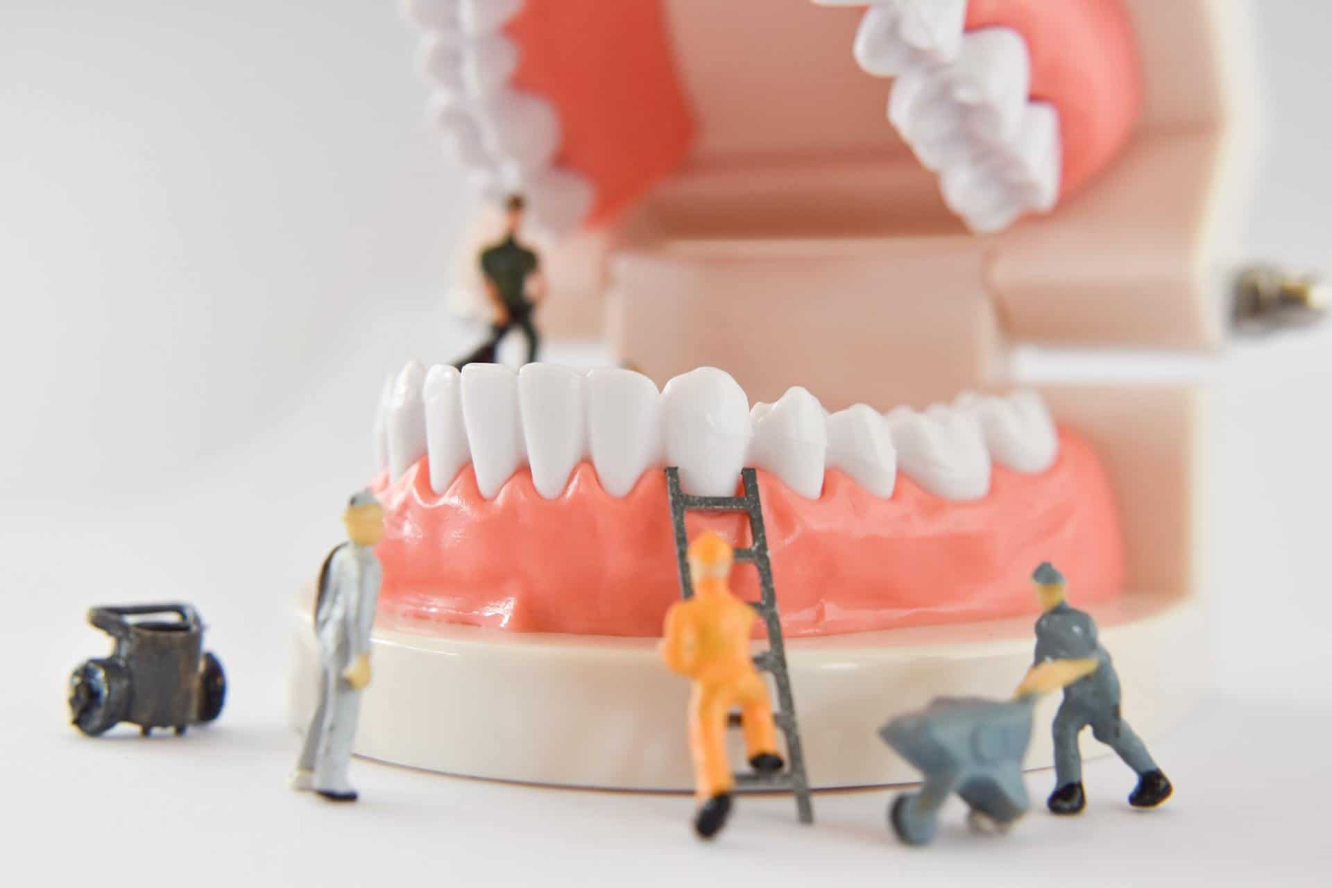 miniature people to repair a tooth or worker cleaning tooth model as medical and healthcare