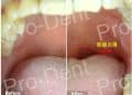 pjimage-22