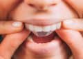 Whitestrips or Teeth Whitening Strips.