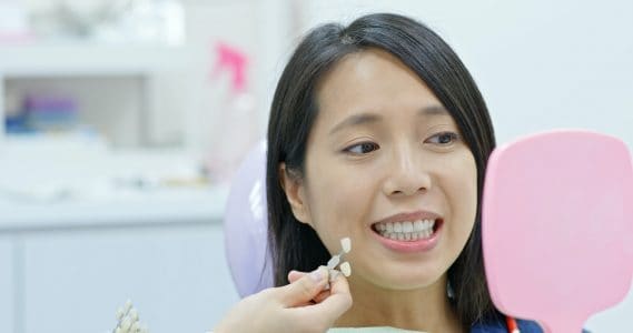 Woman go dental clinic for whitening teeth