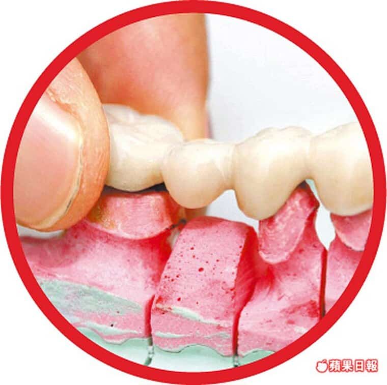 牙科醫師告訴您-護齒5錯誤-加速熟齡爛牙-柏登牙醫診所-醫師團隊-衛教資訊-11
