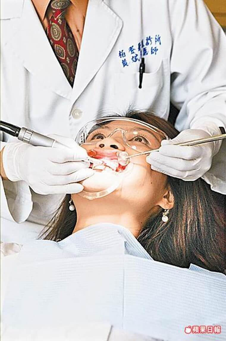 牙齒美白激增3成-六月結婚潮-柏登牙醫-美白牙齒衛教5-2